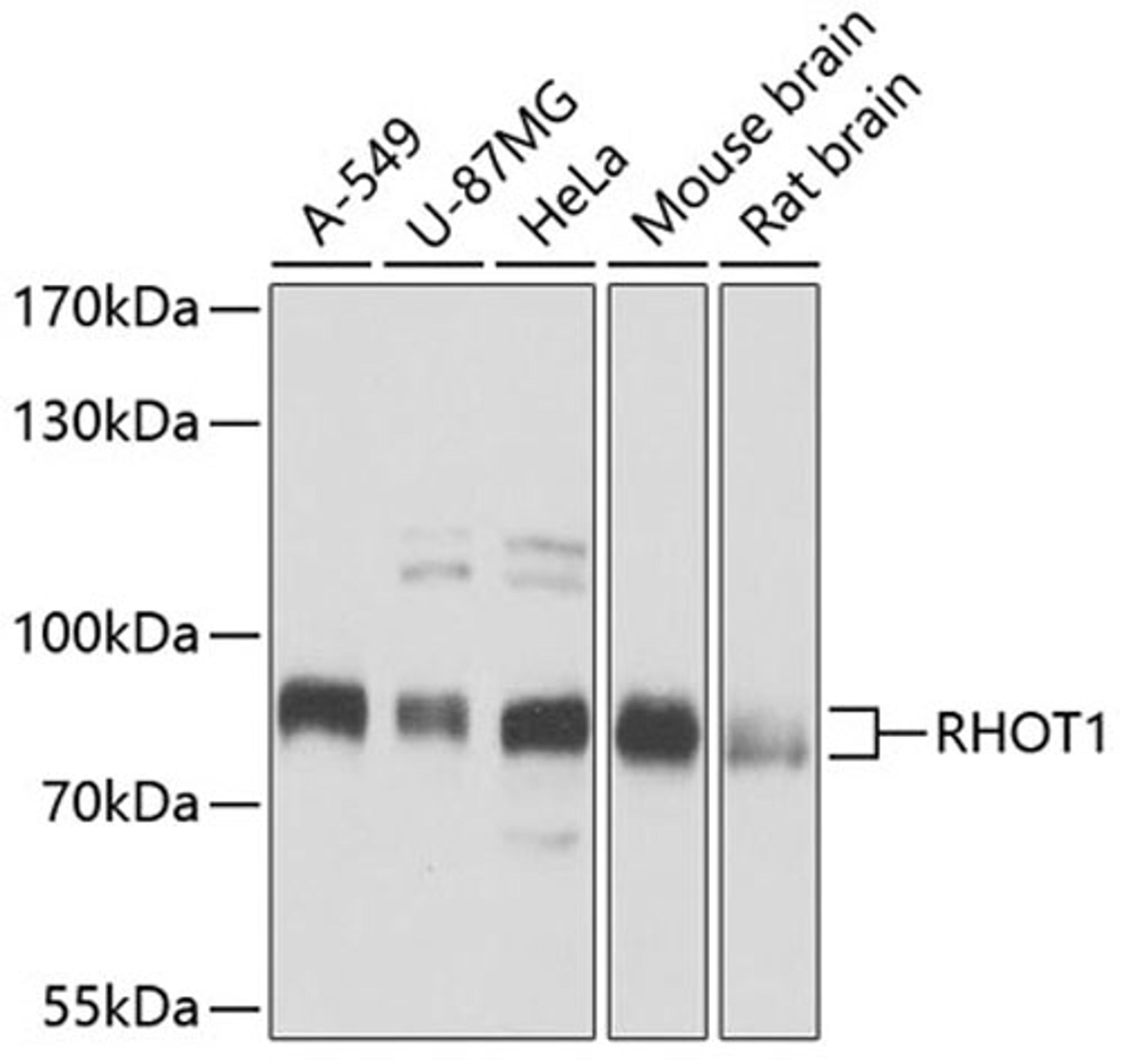 Western blot - RHOT1 antibody (A5838)