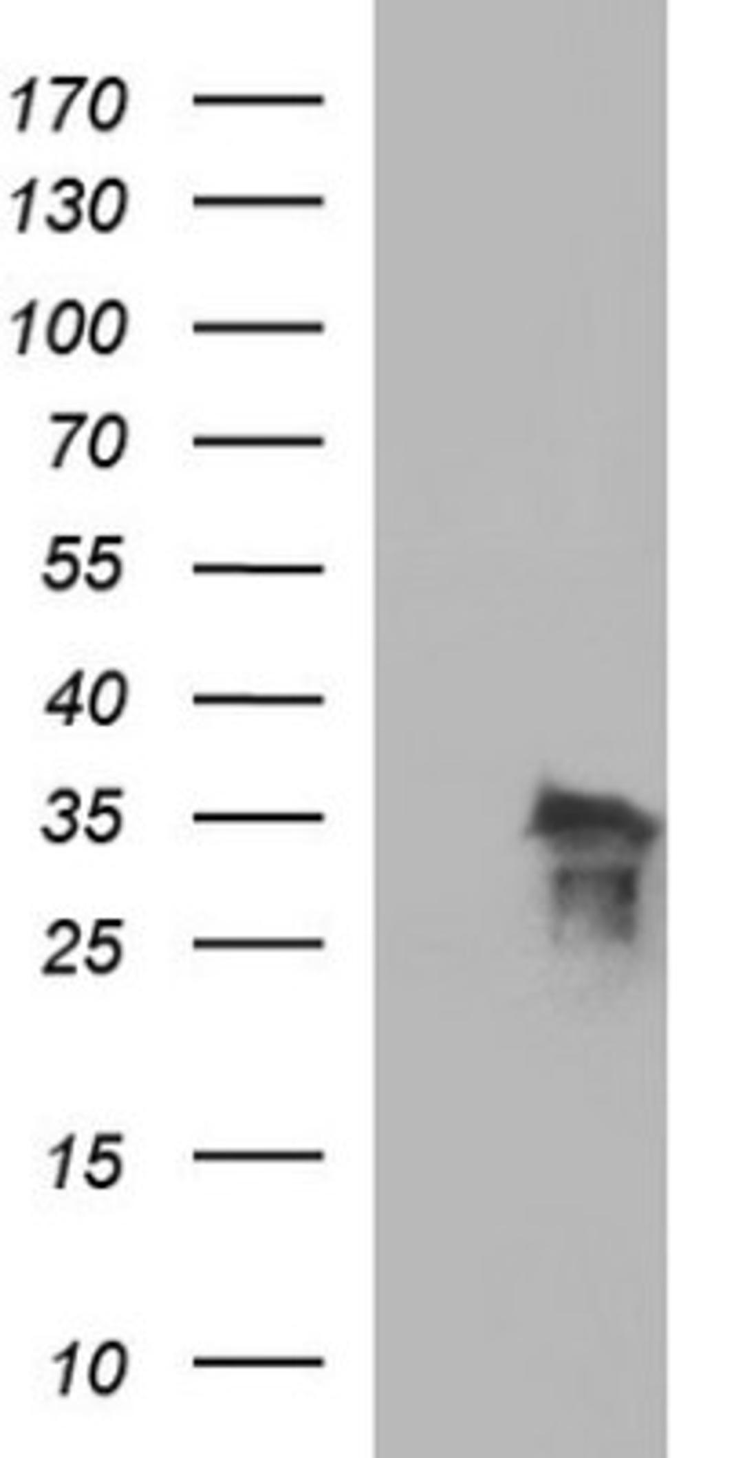 Western Blot: POLR3GL Antibody (5E8) [NBP2-45367] - Analysis of HEK293T cells were transfected with the pCMV6-ENTRY control (Left lane) or pCMV6-ENTRY POLR3GL.