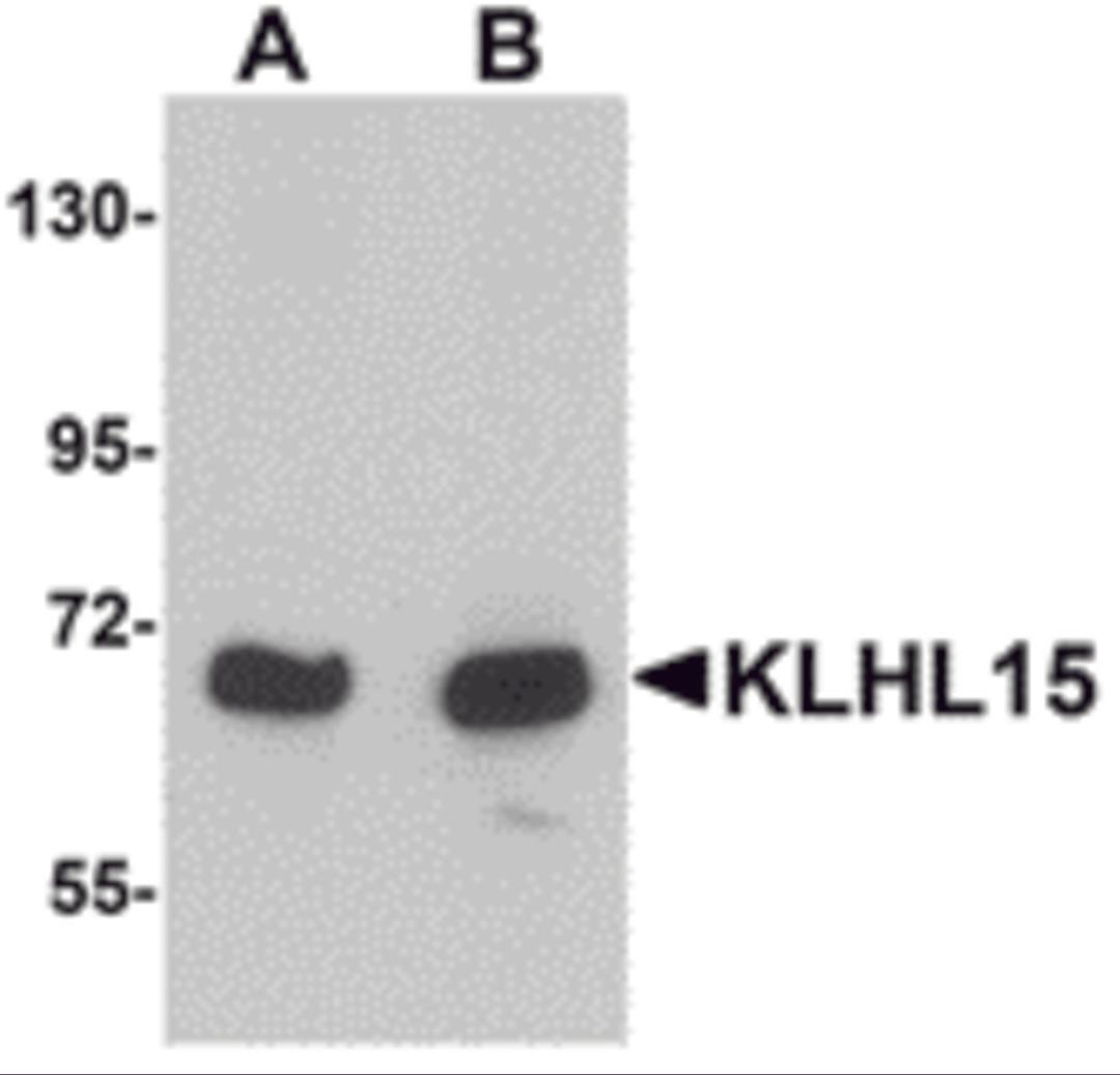 Western blot analysis of KLHL15 in HeLa cell lysate with KLHL15 antibody at (A) 1 and (B) 2 μg/mL.