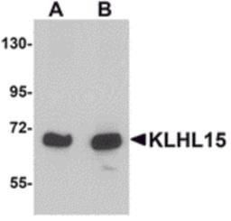Western blot analysis of KLHL15 in HeLa cell lysate with KLHL15 antibody at (A) 1 and (B) 2 μg/mL.