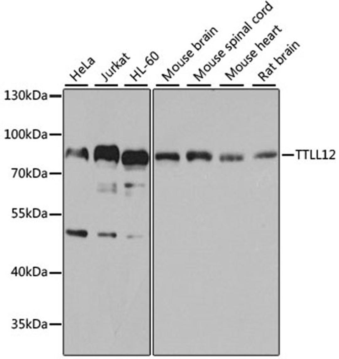 Western blot - TTLL12 antibody (A8197)