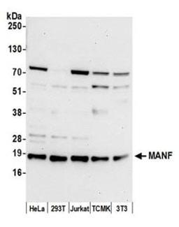 Detection of human and mouse MANF by western blot.