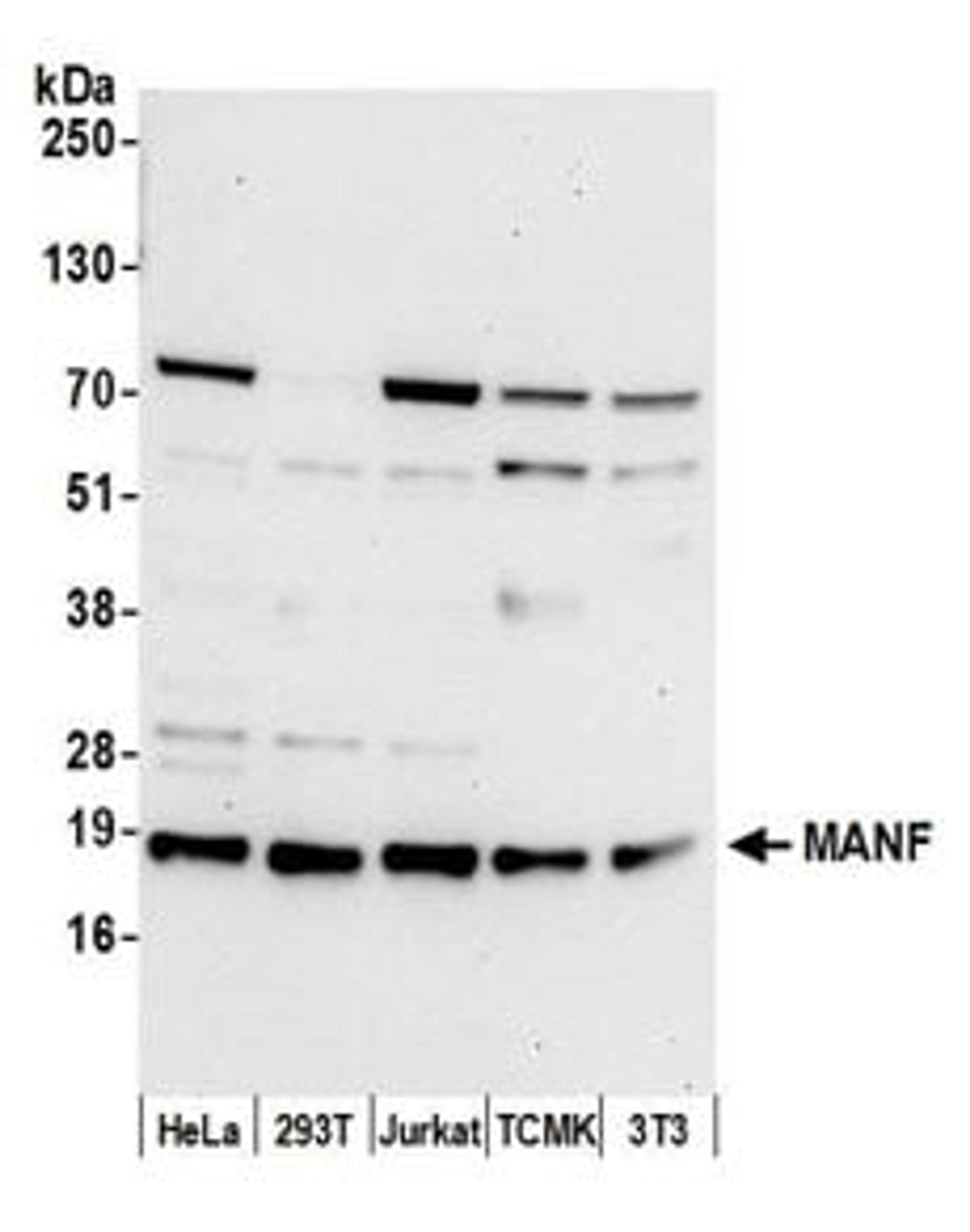 Detection of human and mouse MANF by western blot.