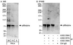 Detection of human p66alpha by western blot and immunoprecipitation.