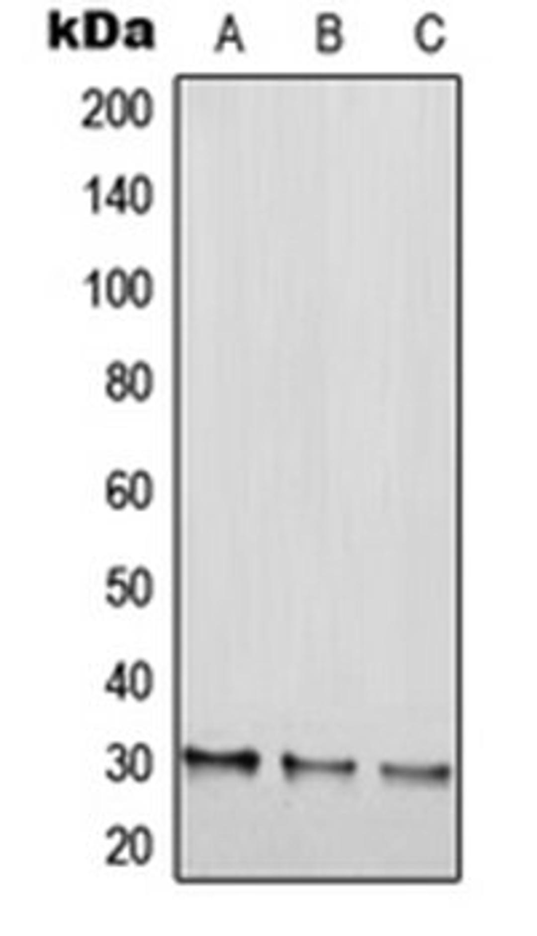 Western blot analysis of HEK293T (Lane 1), NIH3T3 (Lane 2), H9C2 (Lane 3) whole cell lysates using RGS20 antibody