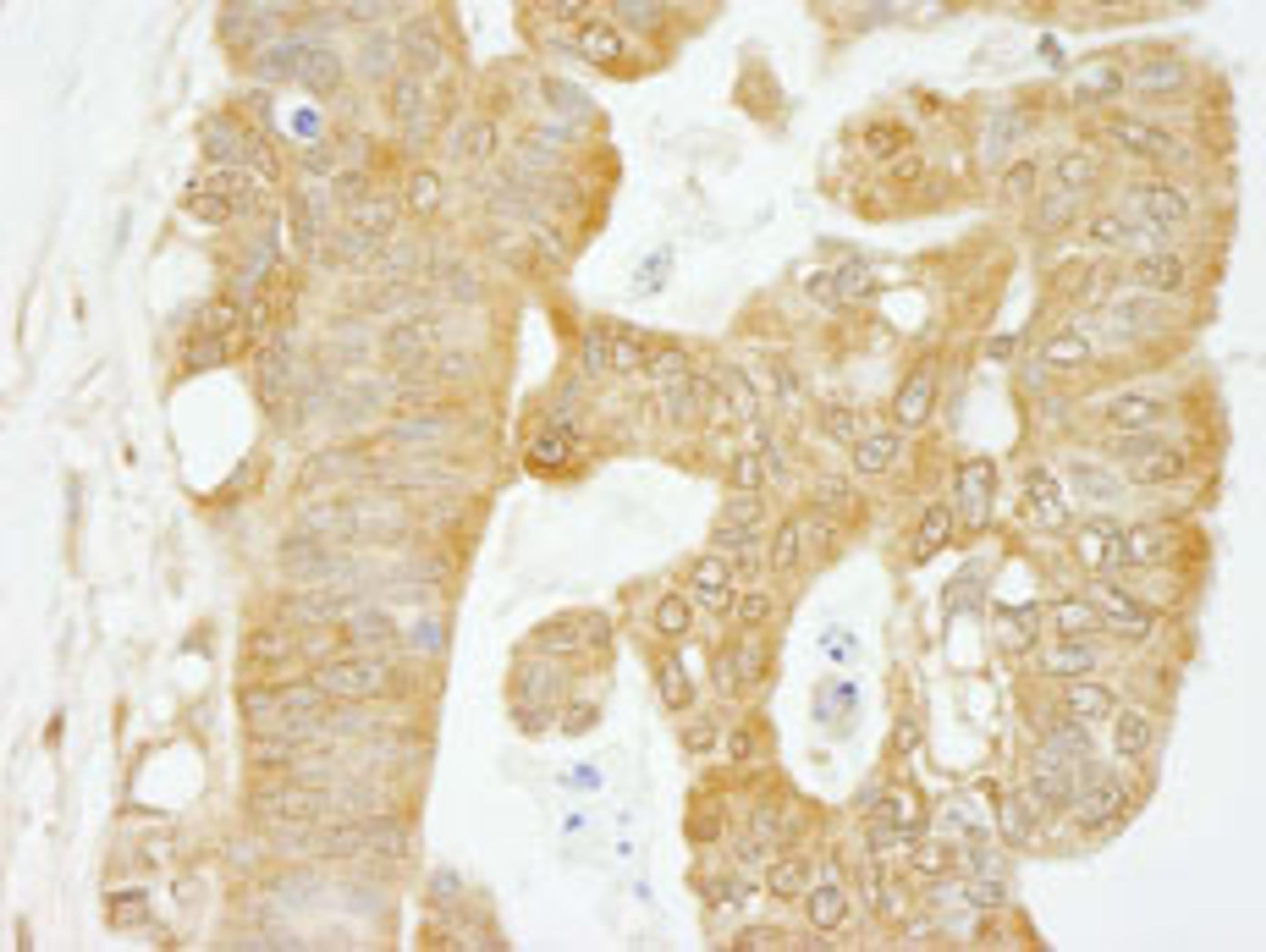 Detection of human eIF4G1 by immunohistochemistry.