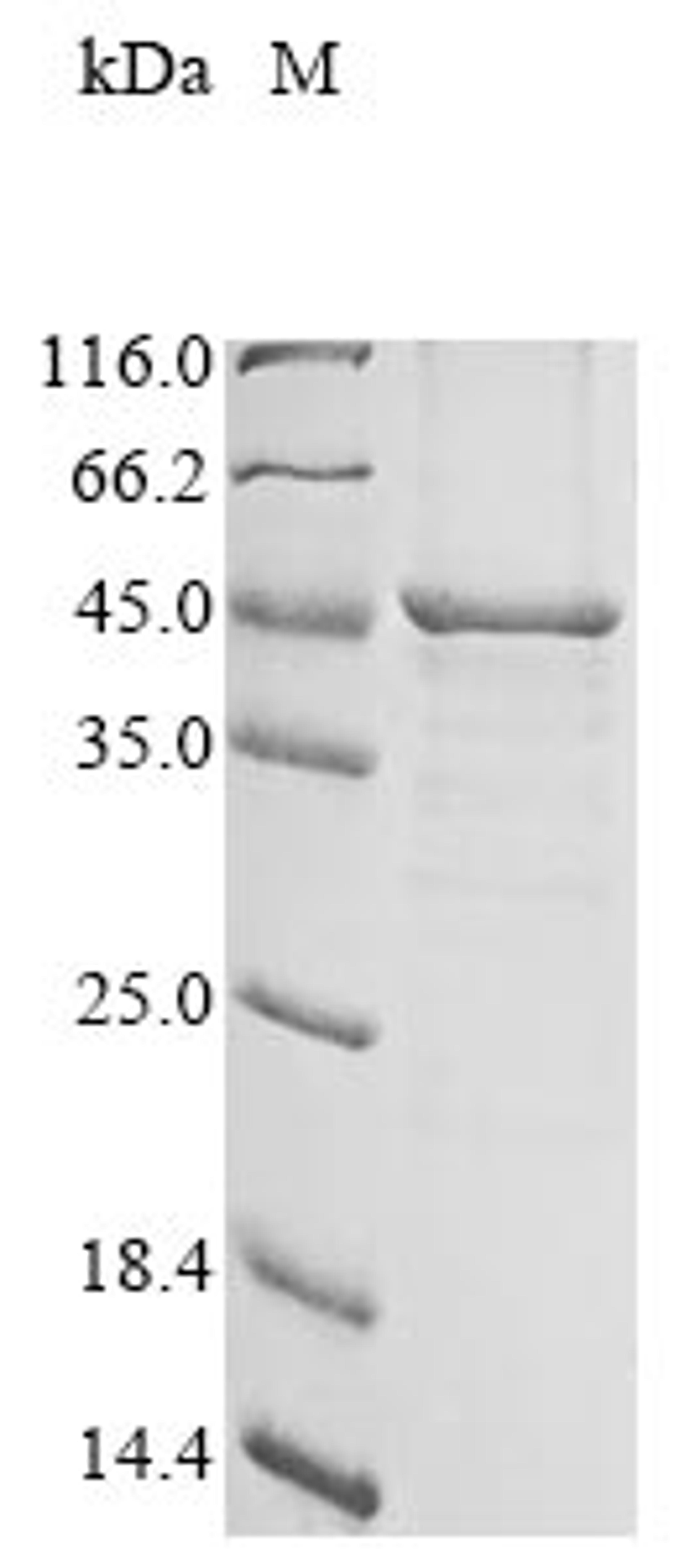(Tris-Glycine gel) Discontinuous SDS-PAGE (reduced) with 5% enrichment gel and 15% separation gel.