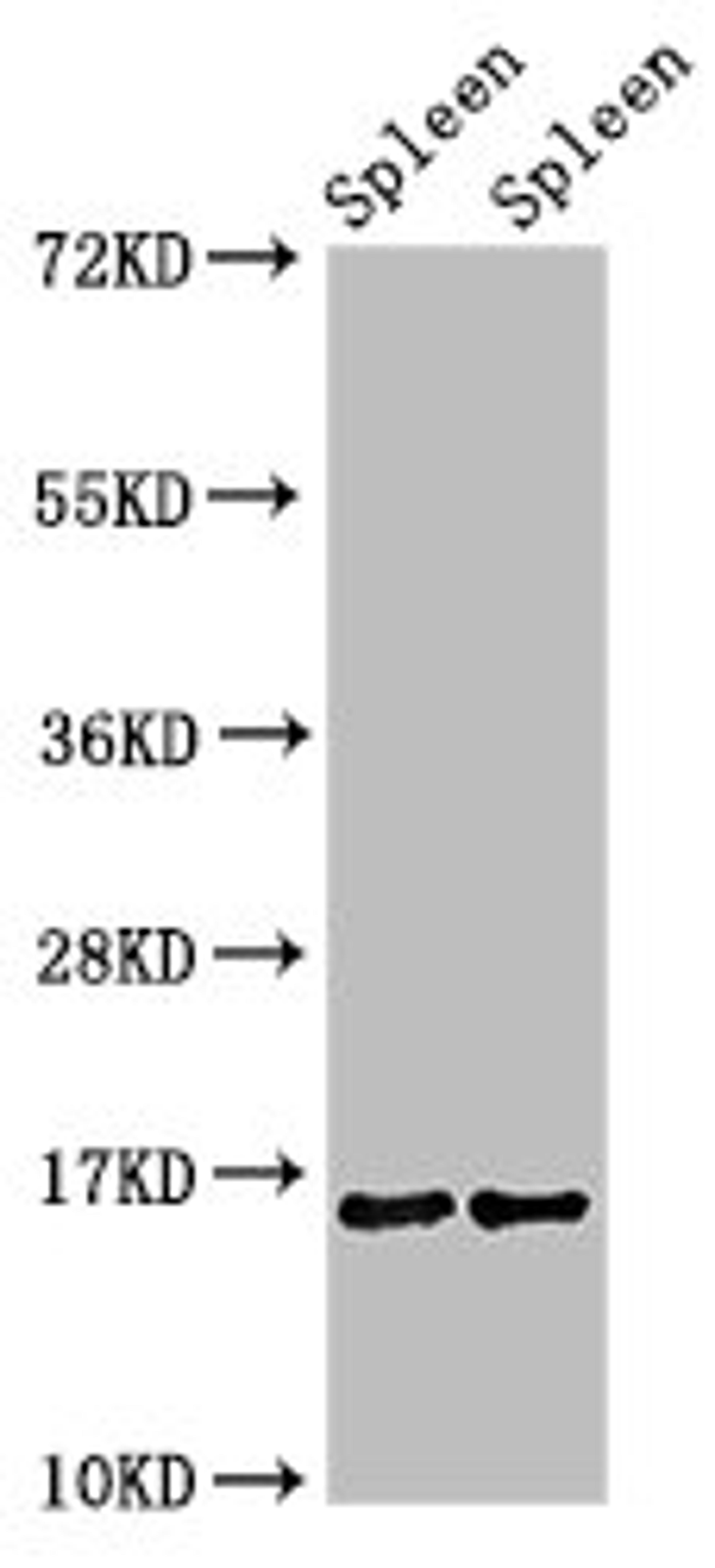 Western Blot. Positive WB detected in: Mouse spleen tissue, Rat spleen tissue. All lanes: HIST1H3A antibody at 1.4µg/ml. Secondary. Goat polyclonal to rabbit IgG at 1/50000 dilution. Predicted band size: 16 kDa. Observed band size: 16 kDa