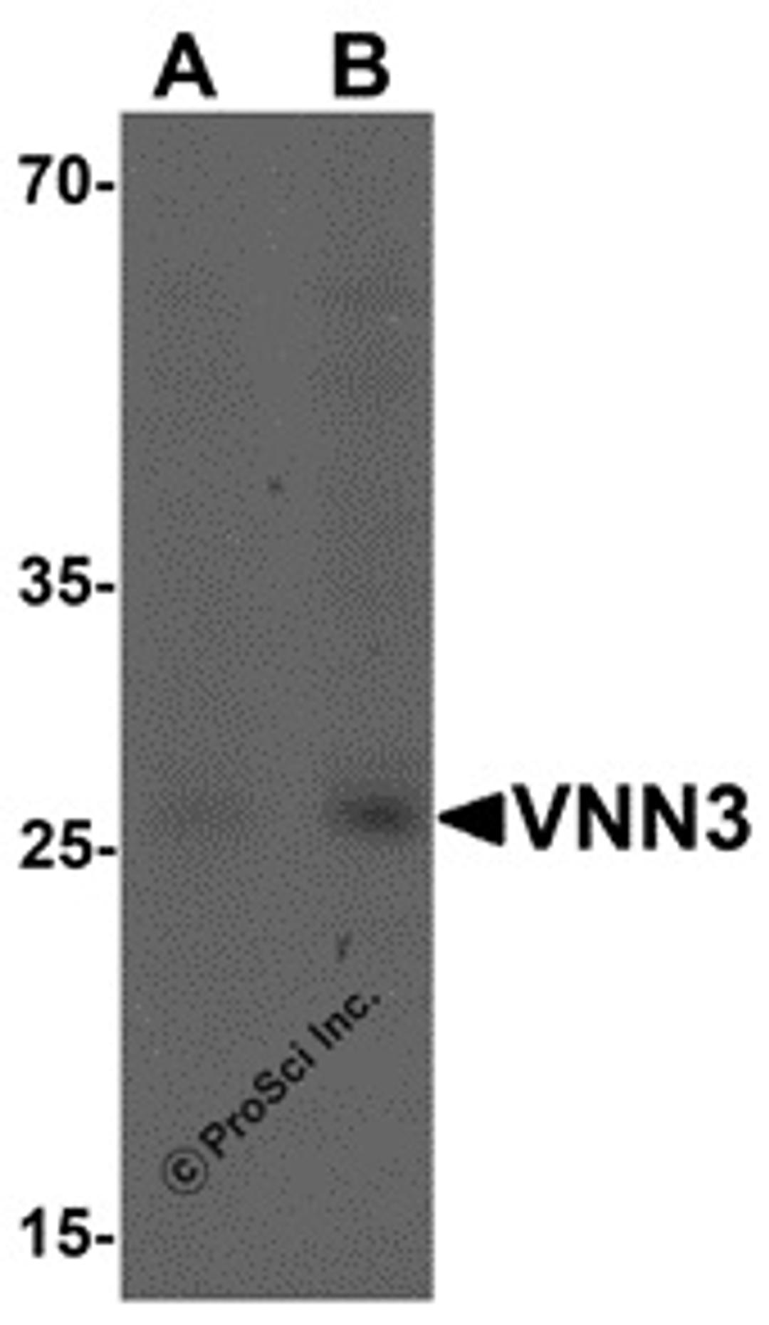 Western blot analysis of VNN3 in human brain tissue lysate with VNN3 antibody at (A) 0.5 and (B) 1 μg/mL.