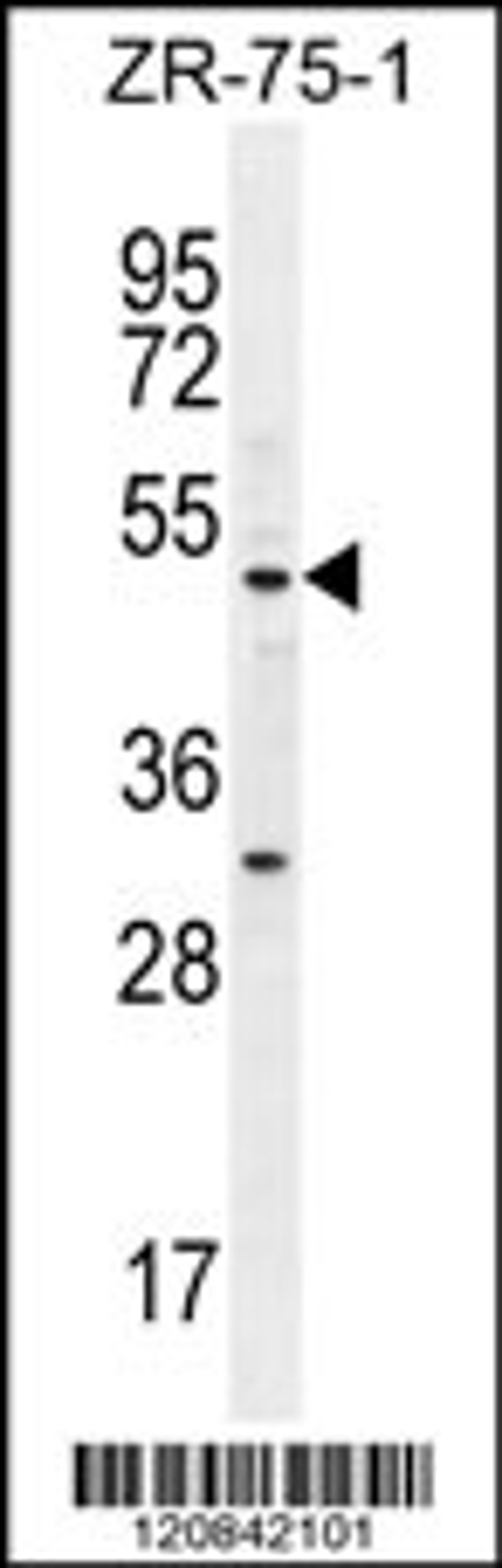 Western blot analysis in ZR-75-1 cell line lysates (35ug/lane).