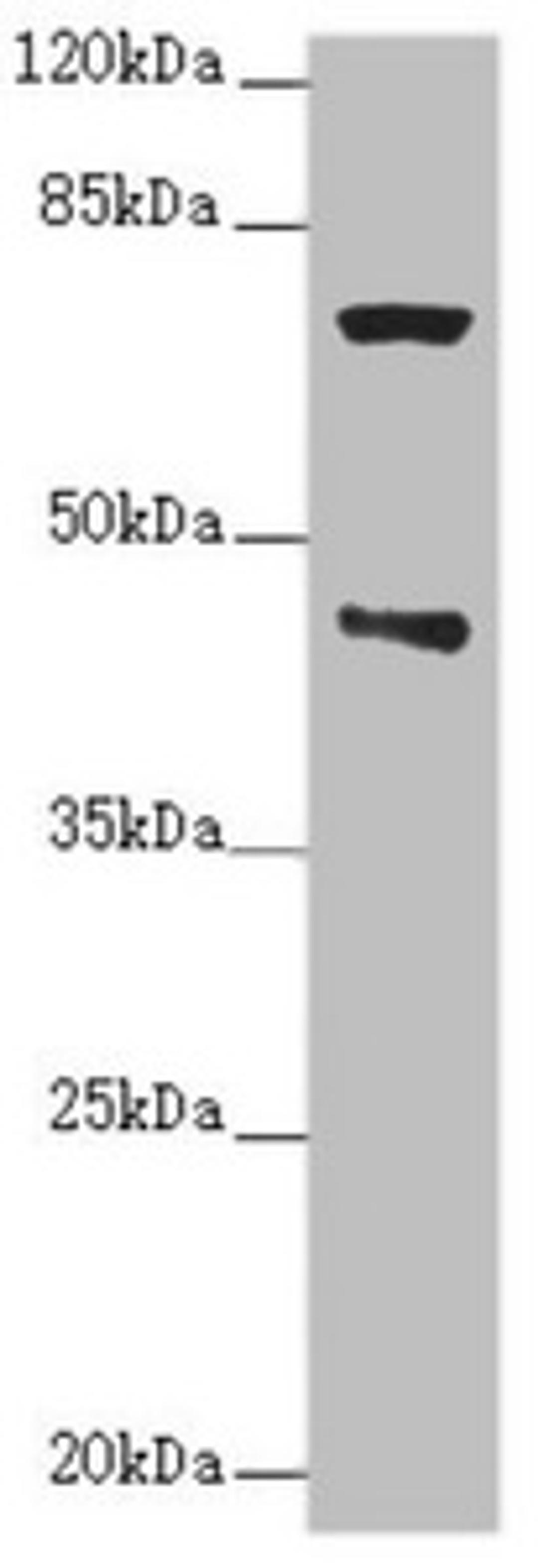 Western blot. All lanes: POC1A antibody at 2.76ug/ml + Raji whole cell lysate. Secondary. Goat polyclonal to rabbit IgG at 1/10000 dilution. Predicted band size: 46, 40, 41 kDa. Observed band size: 46, 70 kDa. 
