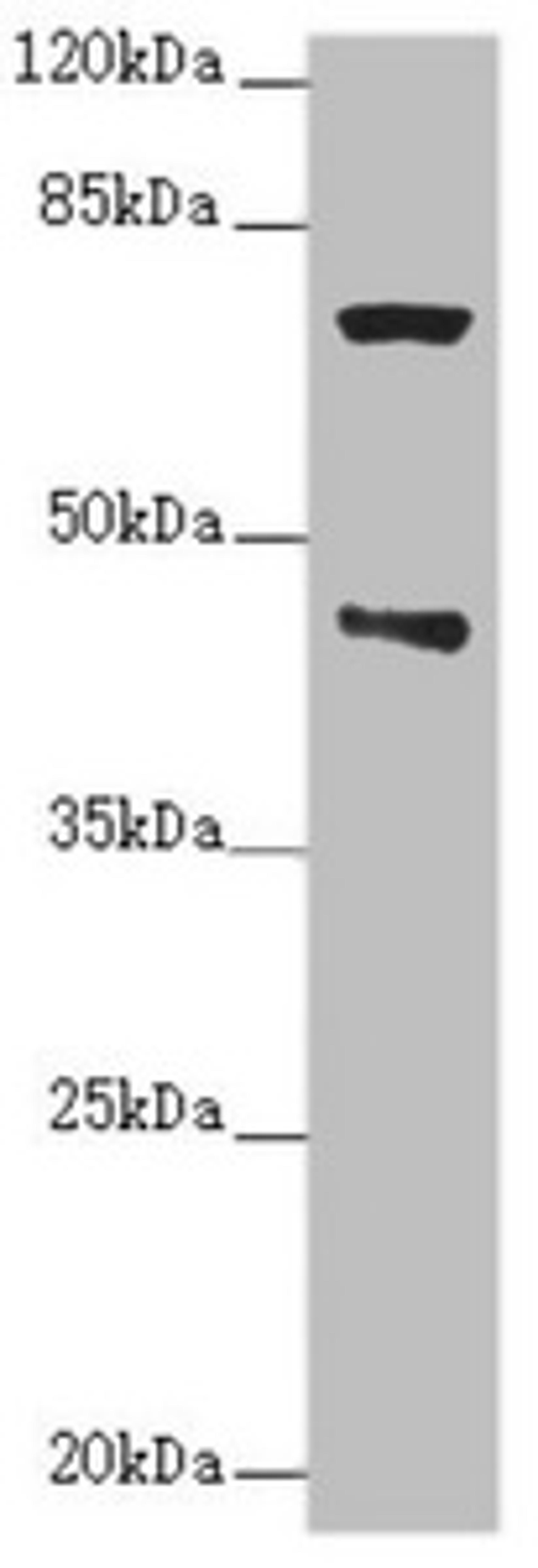 Western blot. All lanes: POC1A antibody at 2.76ug/ml + Raji whole cell lysate. Secondary. Goat polyclonal to rabbit IgG at 1/10000 dilution. Predicted band size: 46, 40, 41 kDa. Observed band size: 46, 70 kDa. 