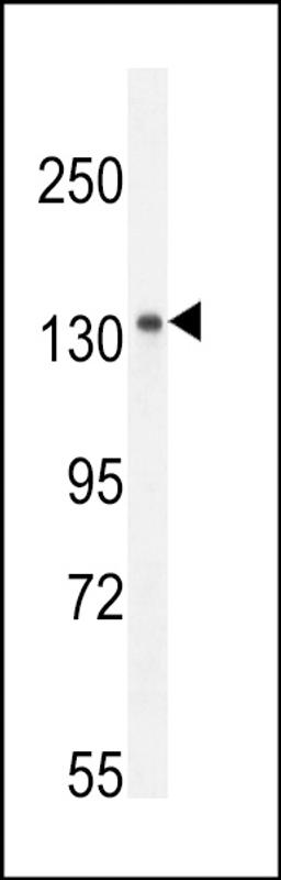 Western blot analysis in mouse spleen tissue lysates (35ug/lane).