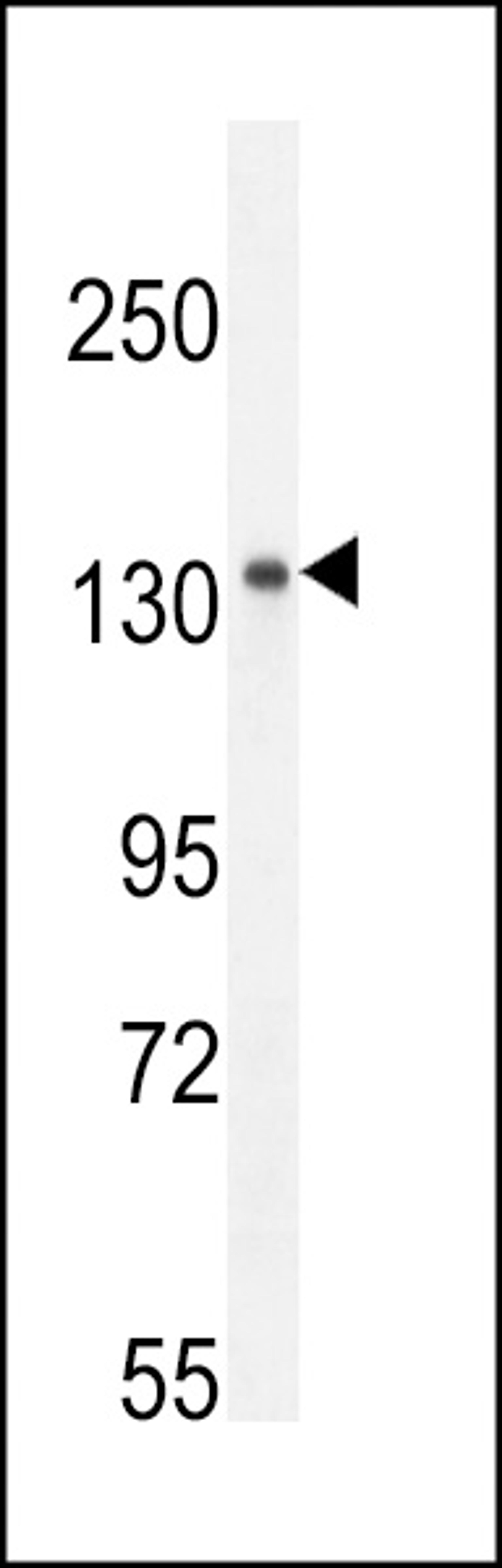 Western blot analysis in mouse spleen tissue lysates (35ug/lane).