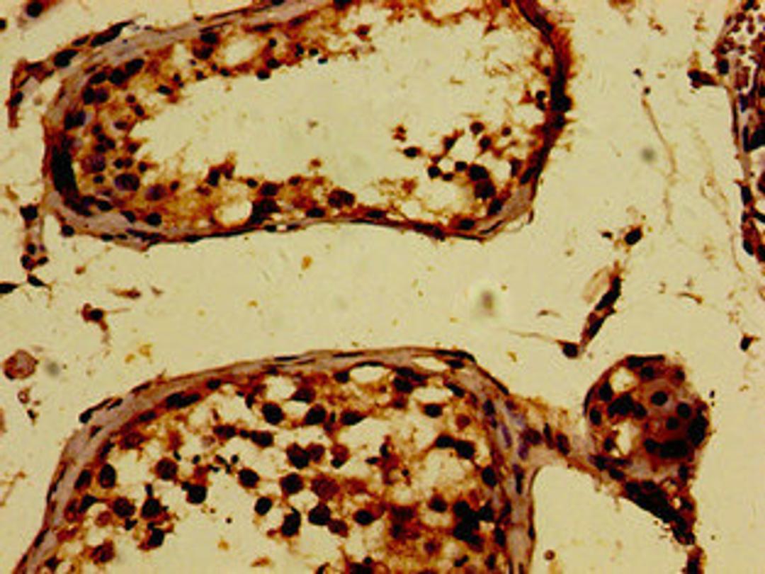 Immunohistochemistry of paraffin-embedded human testis tissue using CSB-PA618787LA01HU at dilution of 1:100