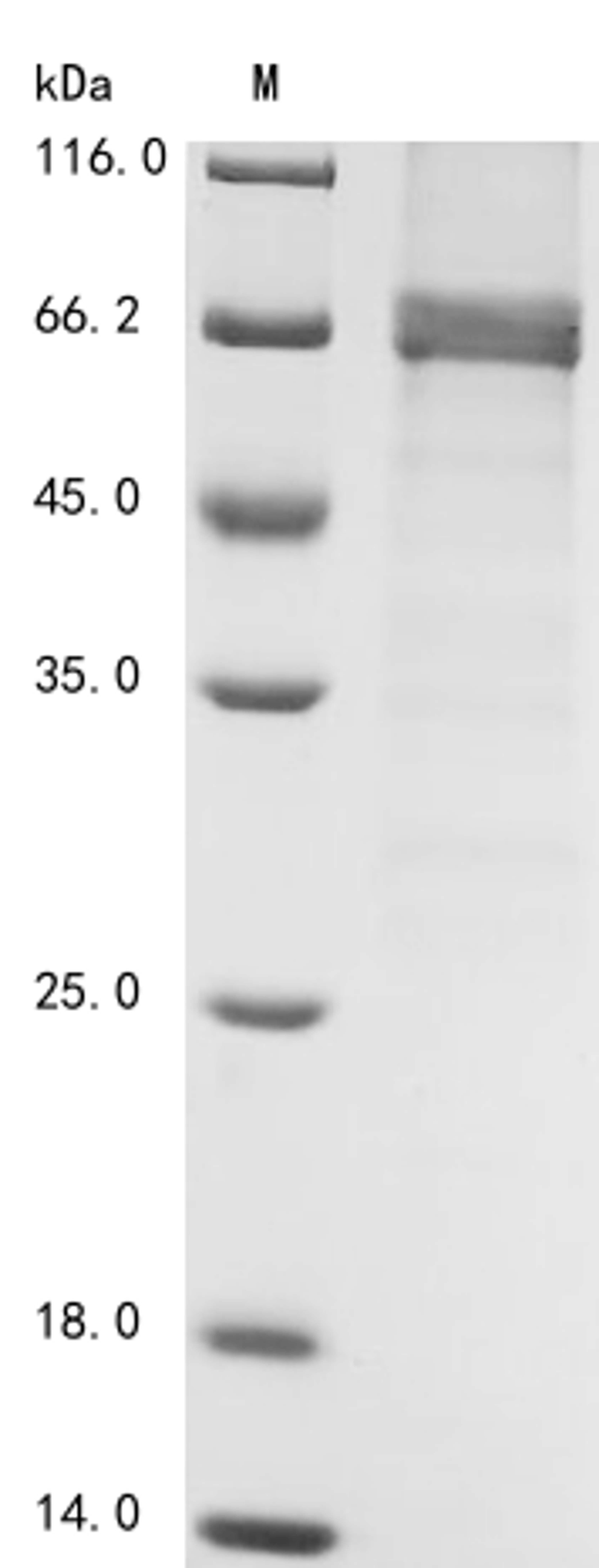 (Tris-Glycine gel) Discontinuous SDS-PAGE (reduced) with 5% enrichment gel and 15% separation gel.