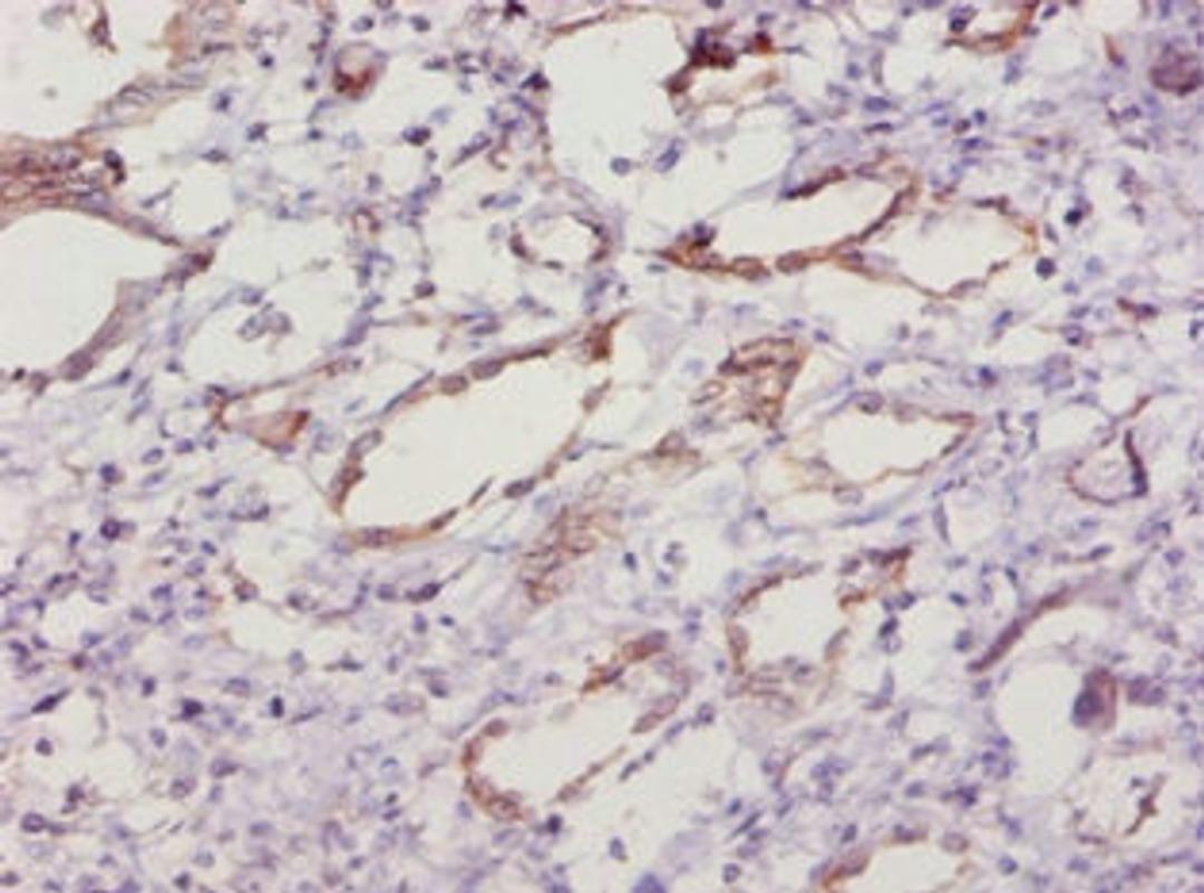 Immunohistochemistry of paraffin-embedded human kidney tissue using CSB-PA022397LA01MO at dilution of 1:10