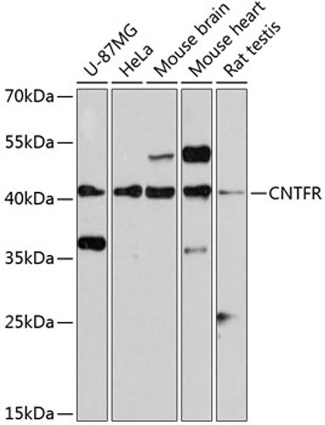 Western blot - CNTFR antibody (A2700)