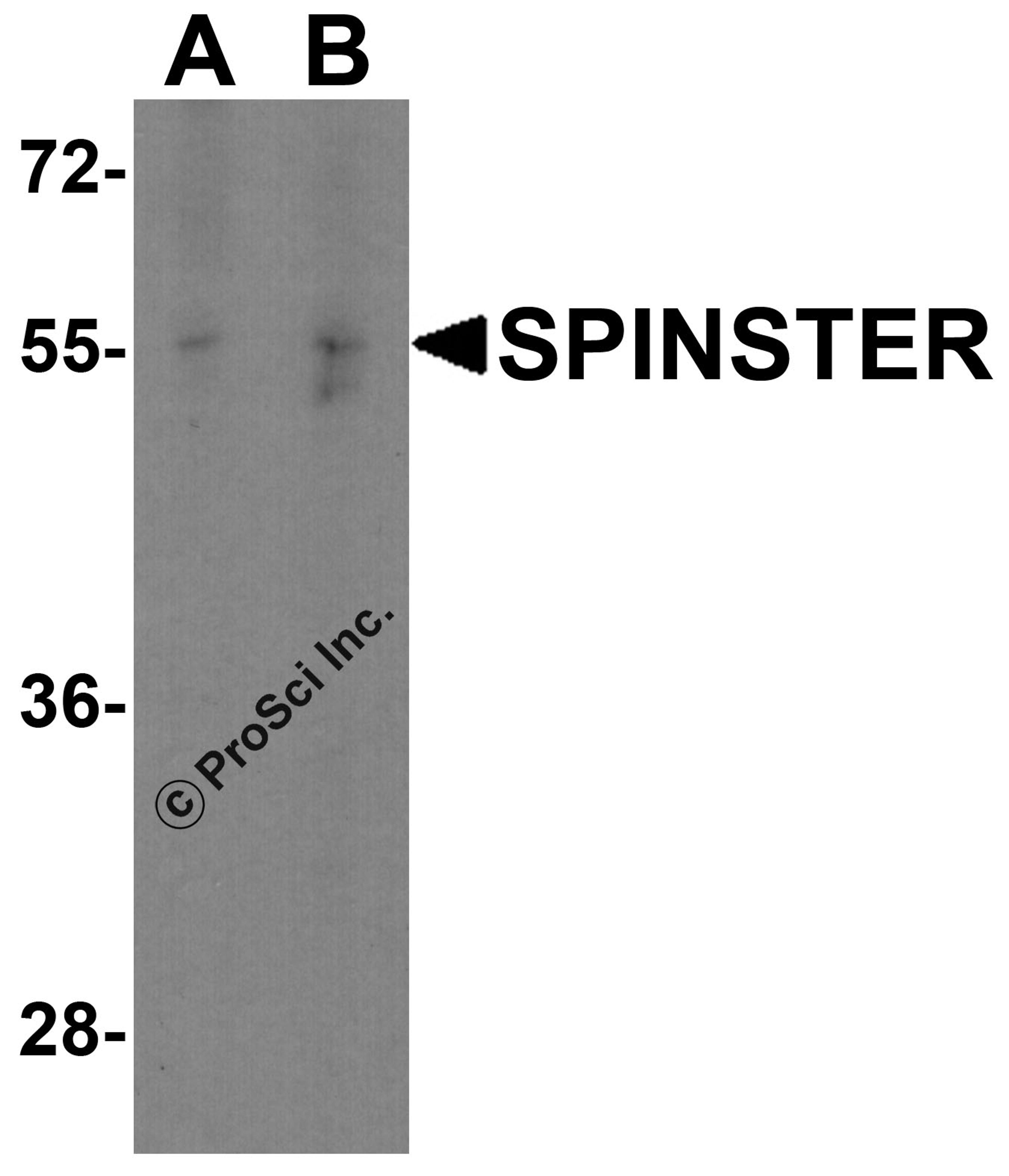 Western blot analysis of SPINSTER in HepG2 cell lysate with SPINSTER antibody at (A) 1 and (B) 2 μg/ml.