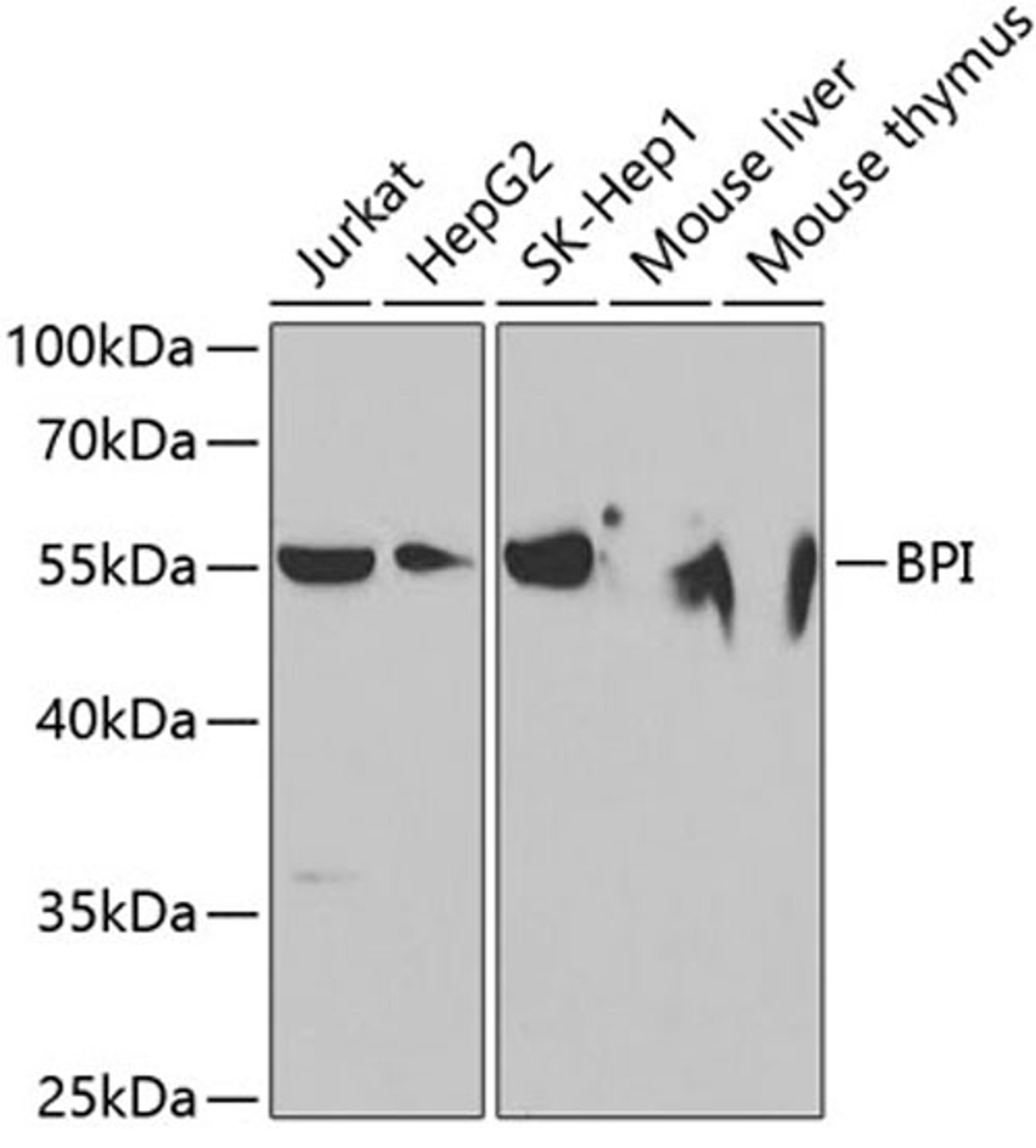 Western blot - BPI antibody (A5338)