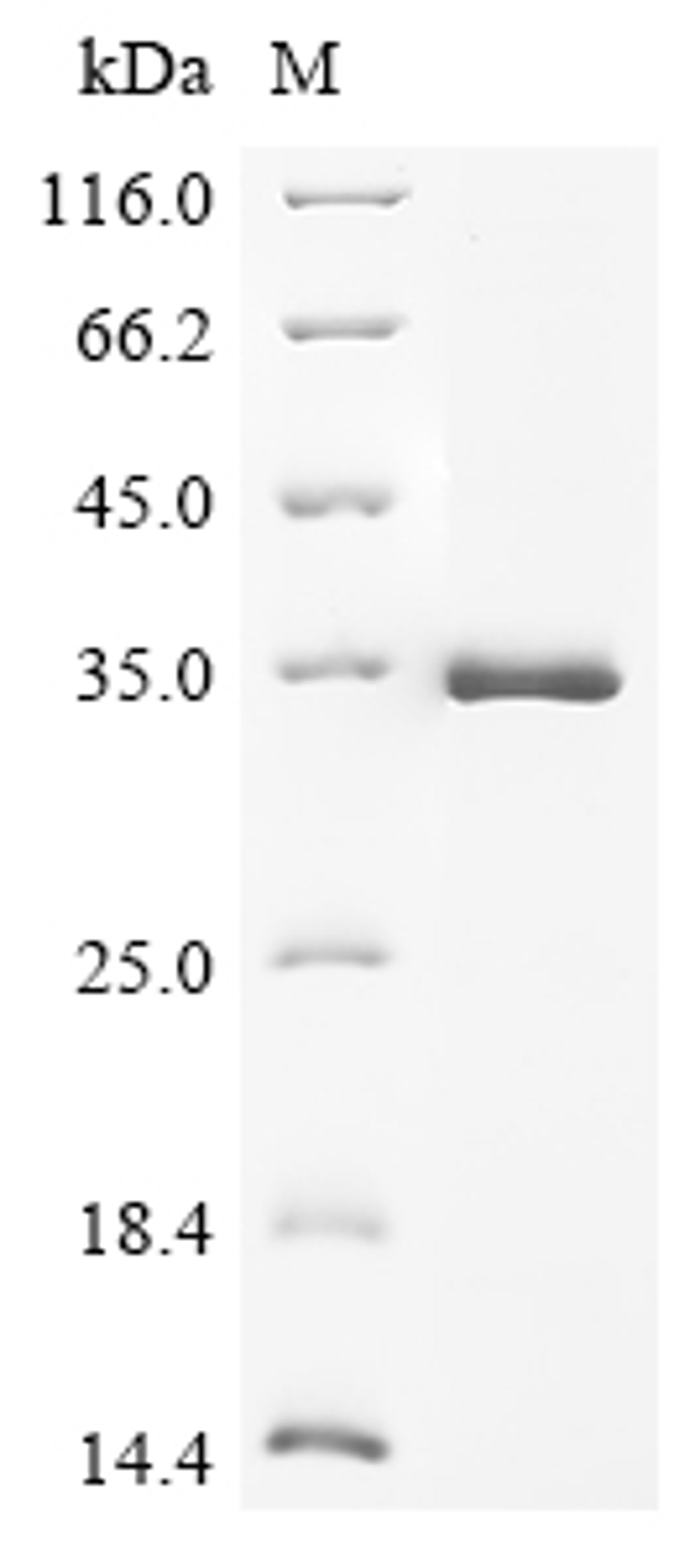 (Tris-Glycine gel) Discontinuous SDS-PAGE (reduced) with 5% enrichment gel and 15% separation gel.