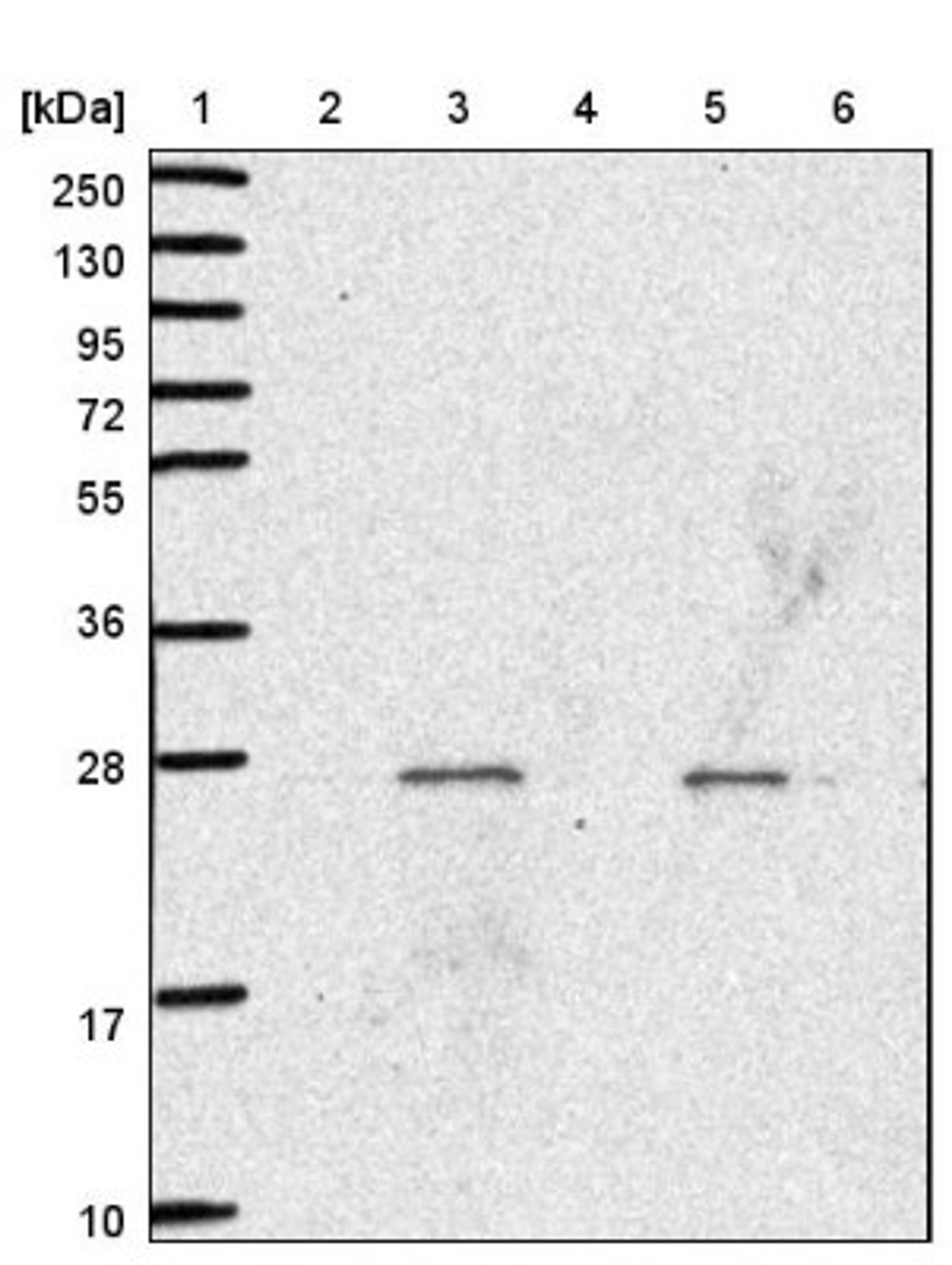 Western Blot: SIRPB2 Antibody [NBP2-33512] - Lane 1: Marker [kDa] 250, 130, 95, 72, 55, 36, 28, 17, 10<br/>Lane 2: Human cell line RT-4<br/>Lane 3: Human cell line U-251MG sp<br/>Lane 4: Human plasma (IgG/HSA depleted)<br/>Lane 5: Human liver tissue<br/>Lane 6: Human tonsil tissue