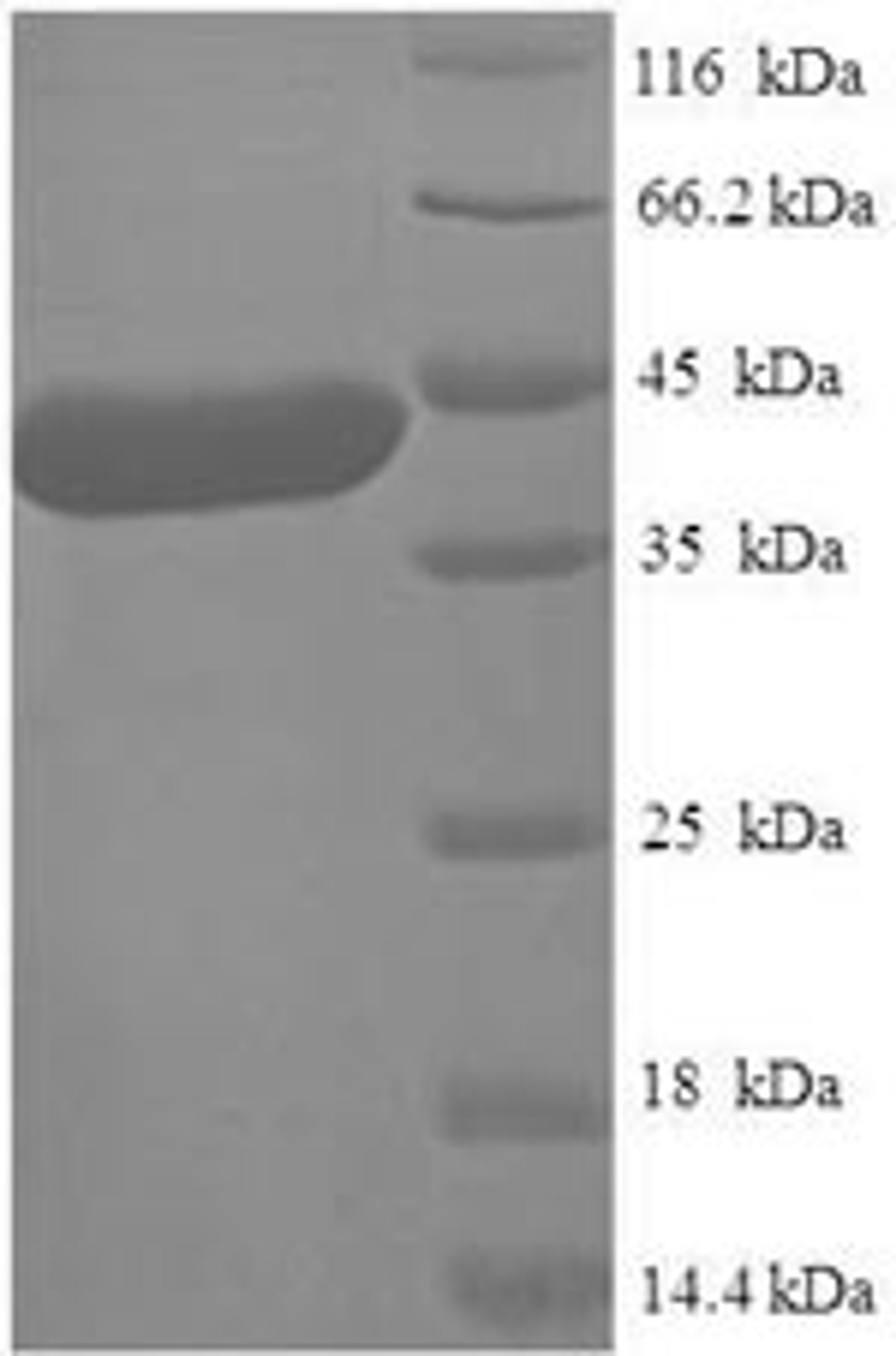 (Tris-Glycine gel) Discontinuous SDS-PAGE (reduced) with 5% enrichment gel and 15% separation gel.