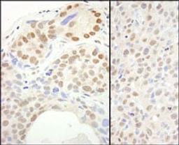 Detection of human and mouse SUPT6H by immunohistochemistry.