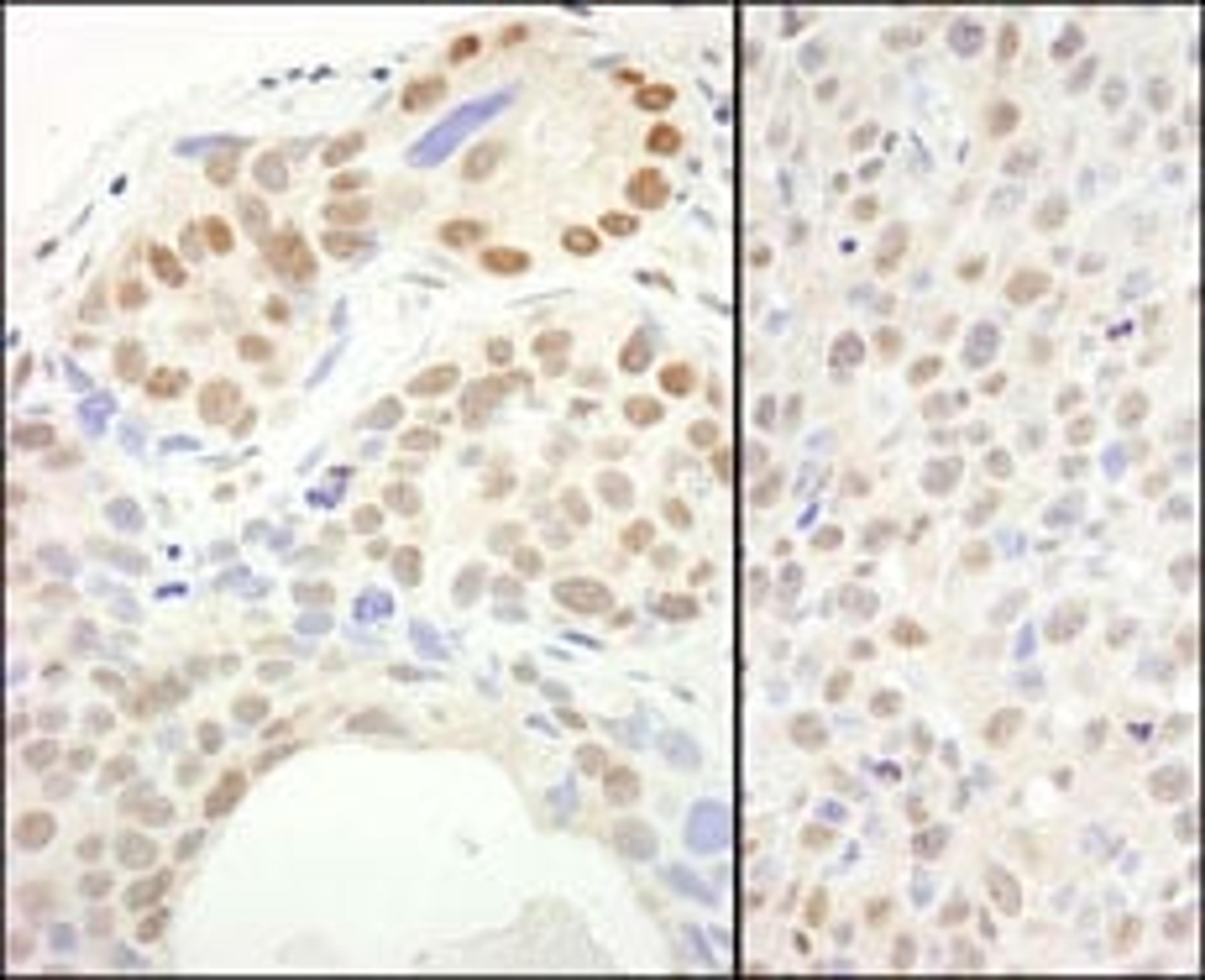 Detection of human and mouse SUPT6H by immunohistochemistry.