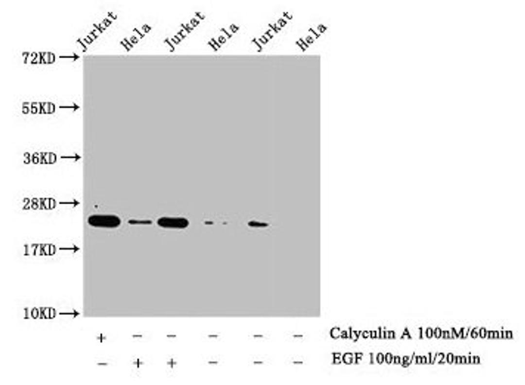 Western Blot. Detected samples: Jurkat whole cell lysate, Hela whole cell lysate; Untreated (-) or treated (+) with Calyculin A and EGF. All lanes: HIST1H1E antibody at 1:1000. Secondary. Goat polyclonal to rabbit IgG at 1/40000 dilution. Predicted band size: 22 kDa. Observed band size: 22 kDa
