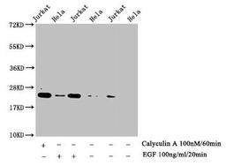 Western Blot. Detected samples: Jurkat whole cell lysate, Hela whole cell lysate; Untreated (-) or treated (+) with Calyculin A and EGF. All lanes: HIST1H1E antibody at 1:1000. Secondary. Goat polyclonal to rabbit IgG at 1/40000 dilution. Predicted band size: 22 kDa. Observed band size: 22 kDa