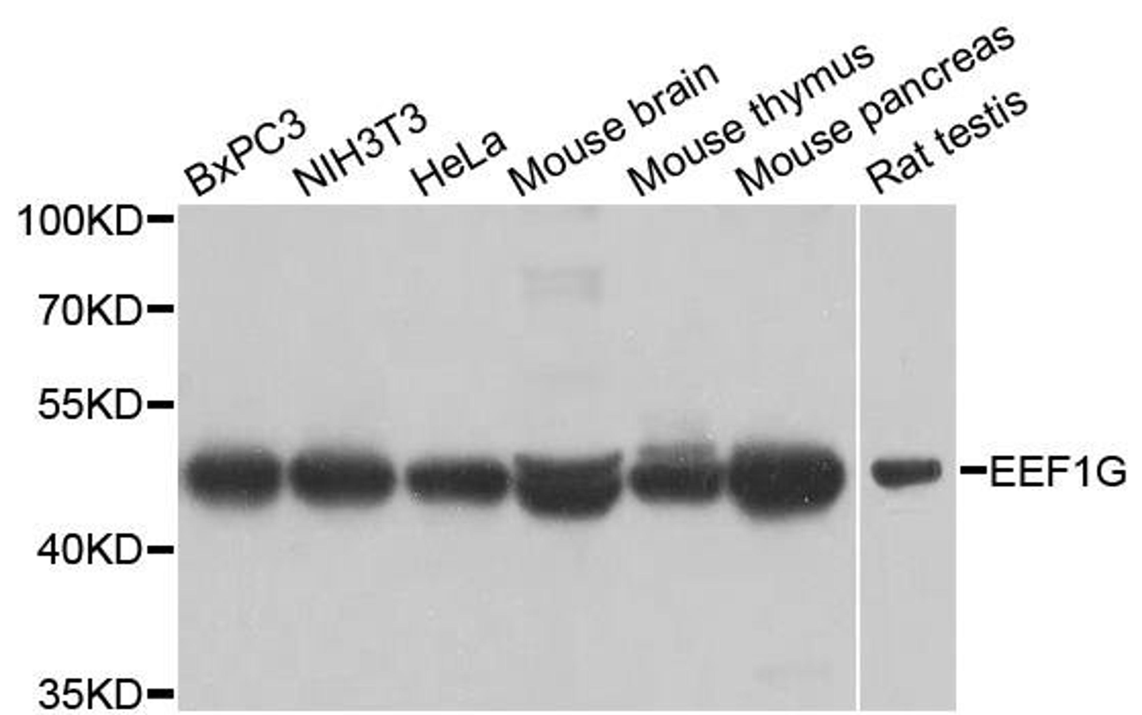 Western blot analysis of extracts of various cell lines using EEF1G antibody