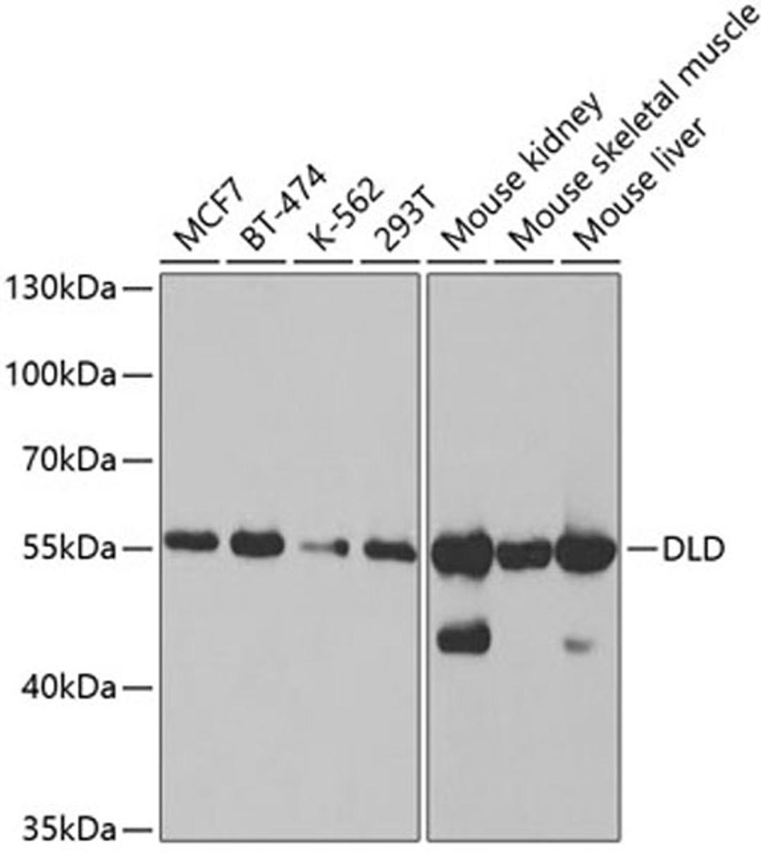 Western blot - DLD antibody (A5403)