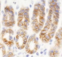 Detection of mouse KIAA0528 by immunohistochemistry.