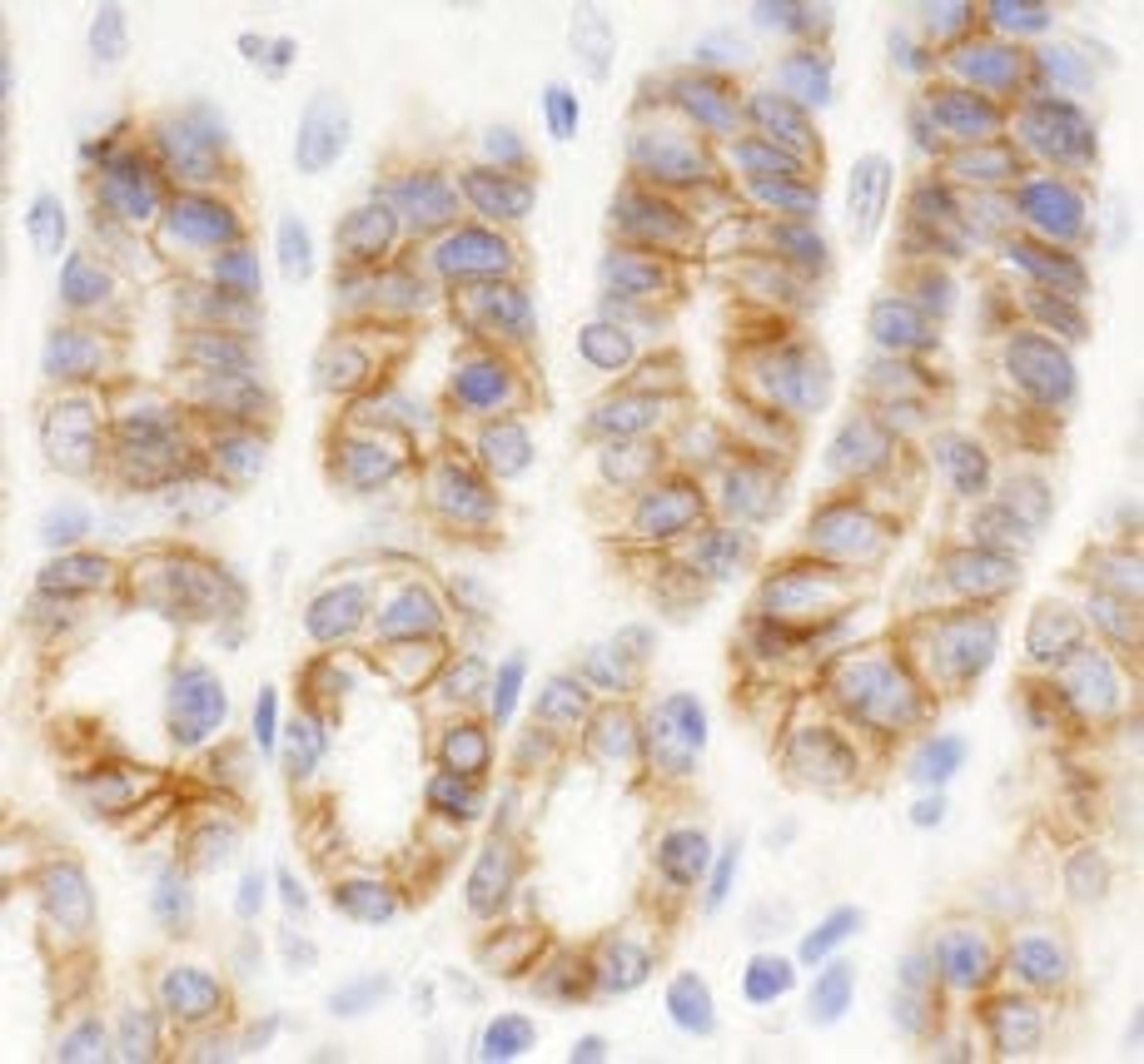 Detection of mouse KIAA0528 by immunohistochemistry.