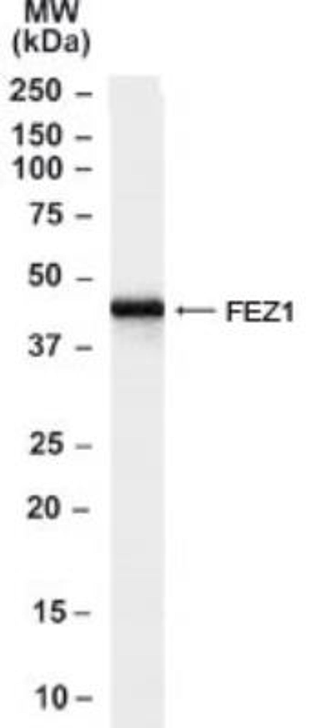 Western Blot: FEZ1 Antibody [NB100-53816] - Analysis of Human brain (frontal Cortex) lysate.