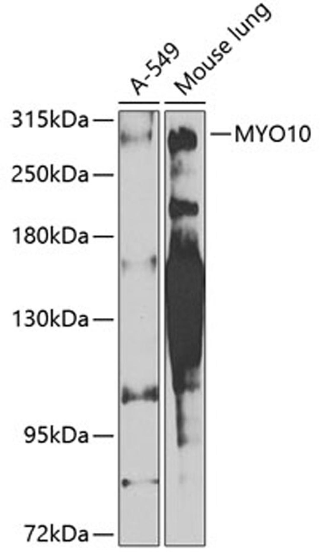 Western blot - MYO10 antibody (A8439)