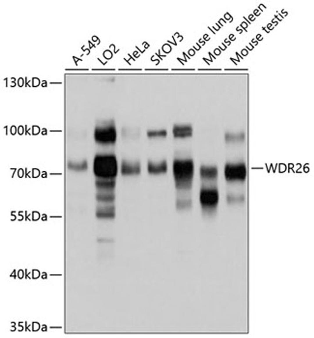 Western blot - WDR26 antibody (A10594)