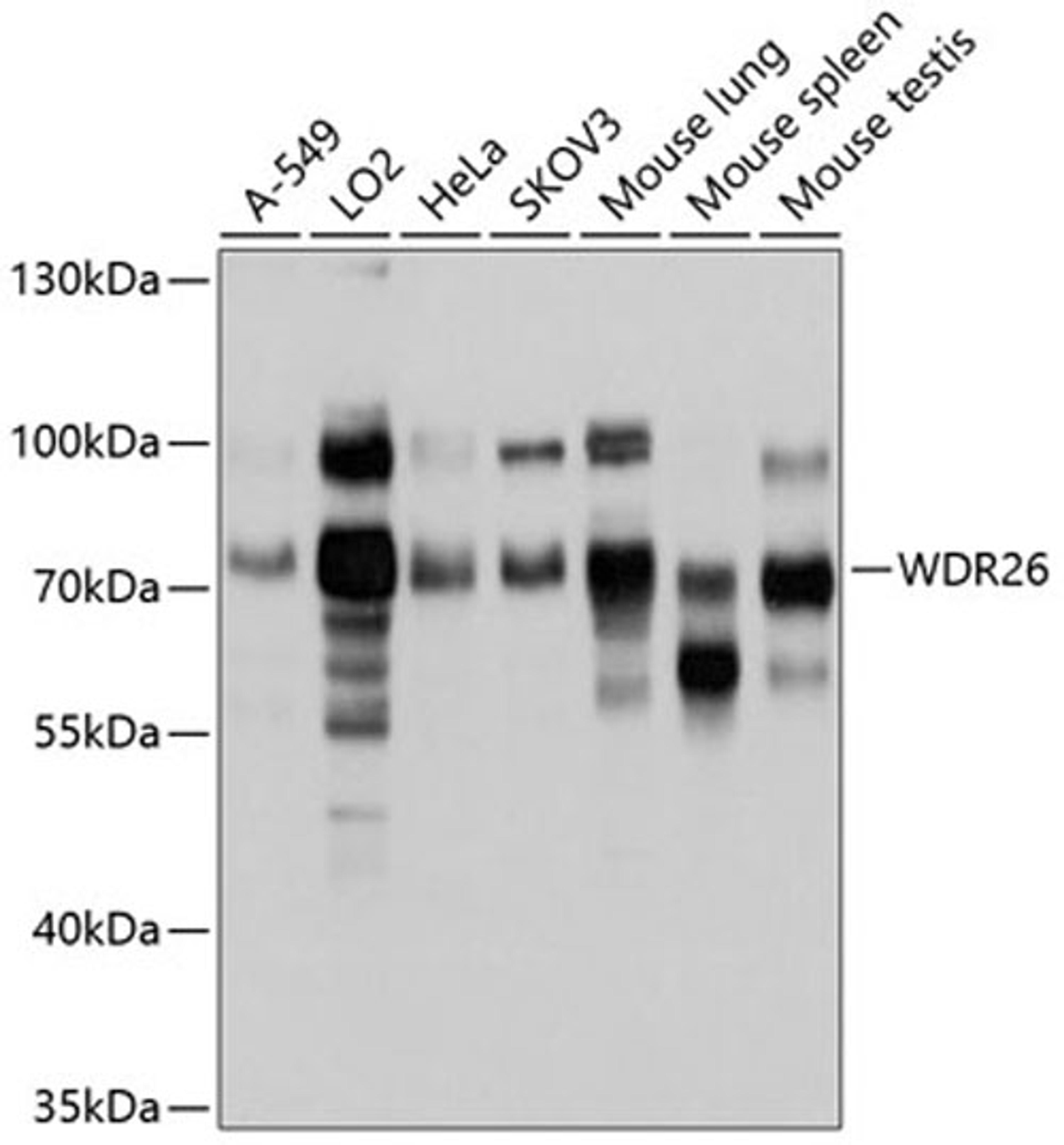 Western blot - WDR26 antibody (A10594)