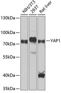 Western blot - YAP1 antibody (A1001)