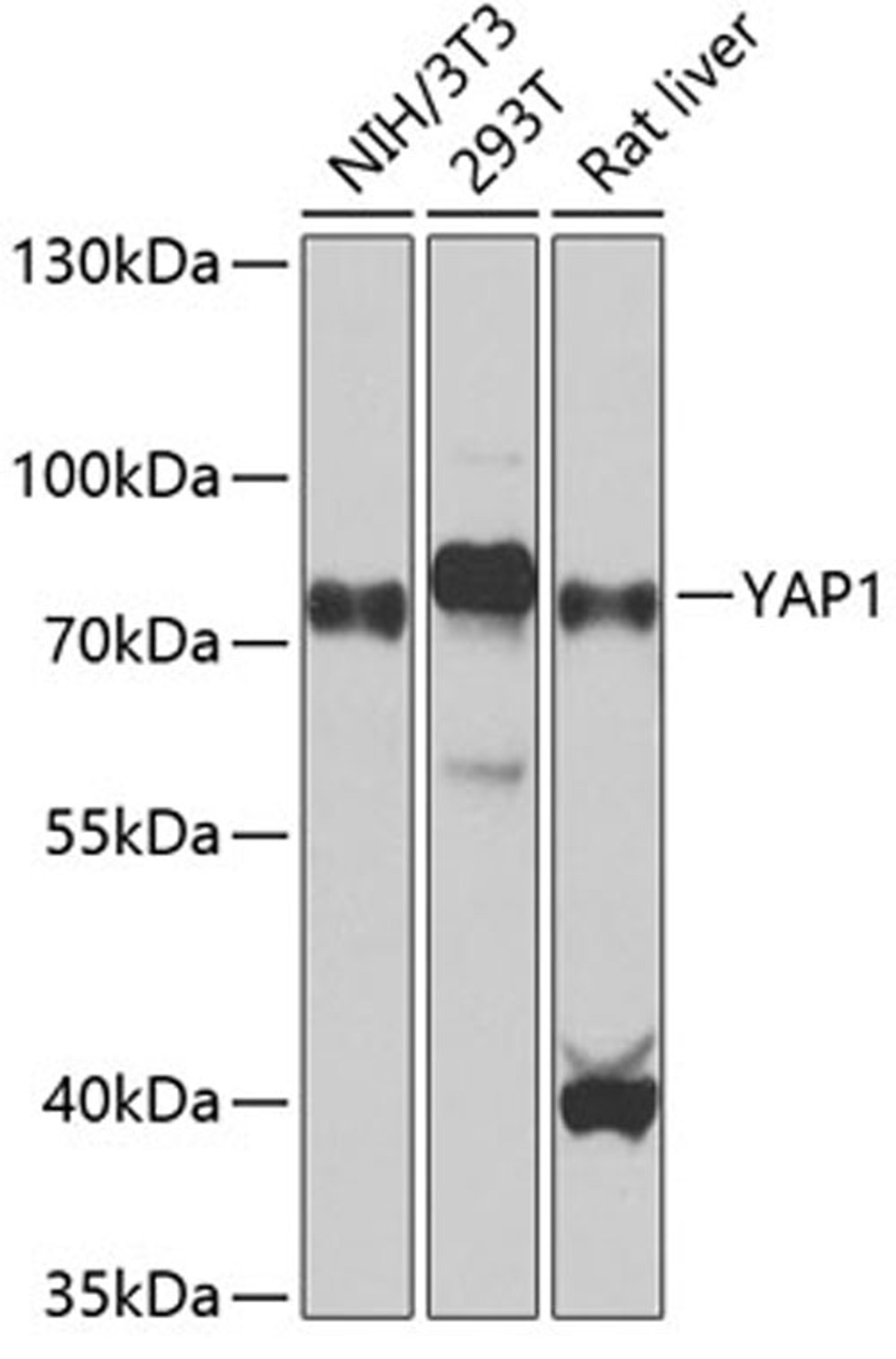 Western blot - YAP1 antibody (A1001)