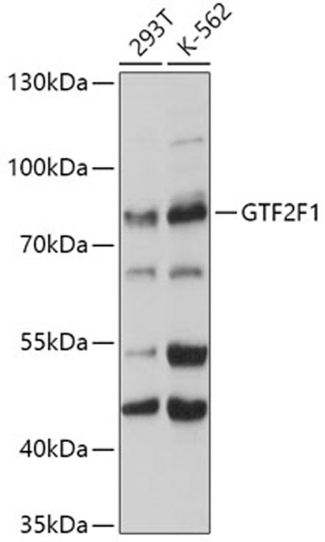 Western blot - GTF2F1 antibody (A2489)