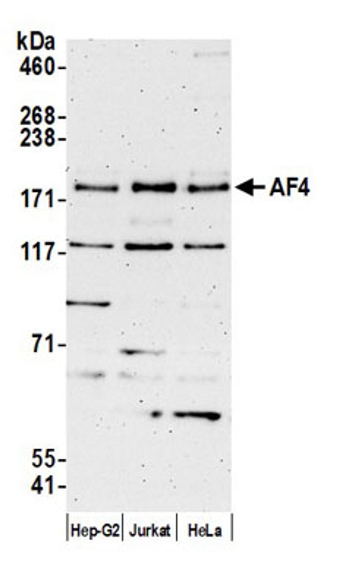 Detection of human AF4 by western blot.