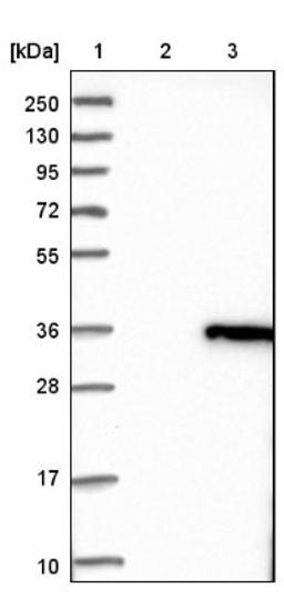 Western Blot: Stomatin Antibody [NBP1-88561] - Lane 1: Marker [kDa] 250, 130, 95, 72, 55, 36, 28, 17, 10<br/>Lane 2: Negative control (vector only transfected HEK293T lysate)<br/>Lane 3: Over-expression lysate (Co-expressed with a C-terminal myc-DDK tag (~3.1 kDa) in mammalian HEK293T cells, LY418214)