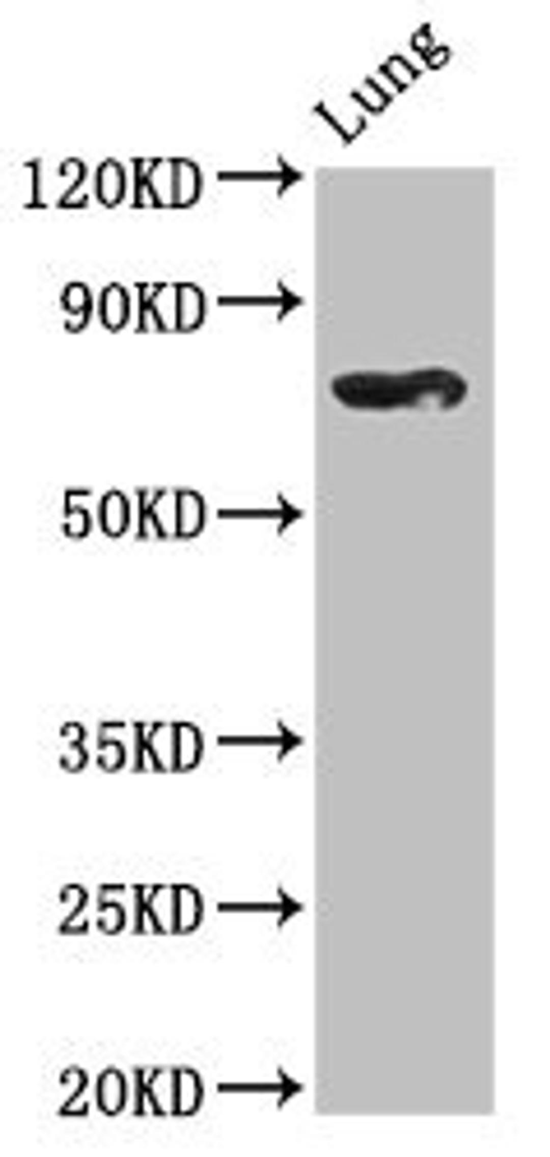 Western Blot. Positive WB detected in: Rat lung tissue. All lanes: TBX2 antibody at 2.5ug/ml. Secondary. Goat polyclonal to rabbit IgG at 1/50000 dilution. Predicted band size: 76 kDa. Observed band size: 76 kDa. 