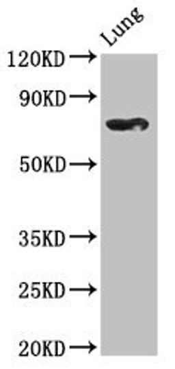Western Blot. Positive WB detected in: Rat lung tissue. All lanes: TBX2 antibody at 2.5ug/ml. Secondary. Goat polyclonal to rabbit IgG at 1/50000 dilution. Predicted band size: 76 kDa. Observed band size: 76 kDa. 