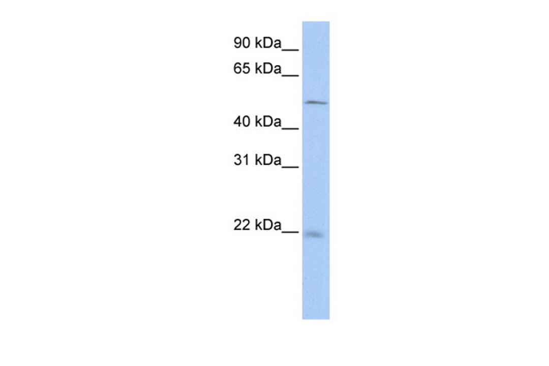 Antibody used in WB on Human HeLa at 0.2-1 ug/ml.