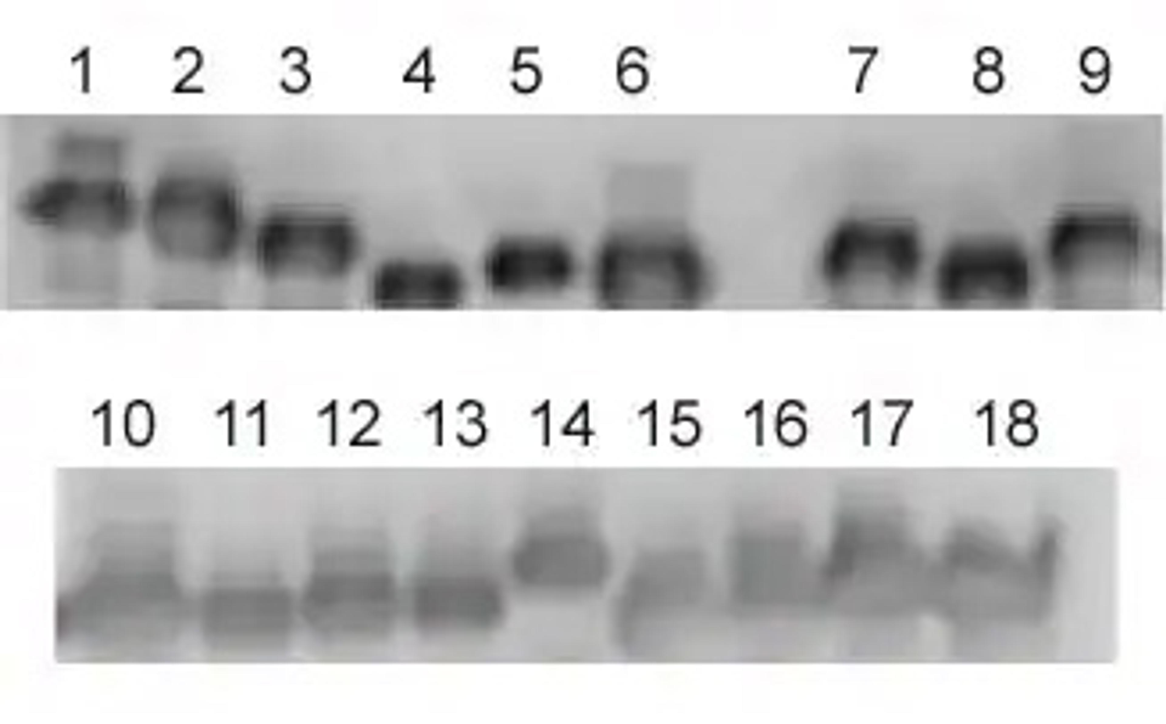 Western blot - Anti-HLA Class 1 ABC antibody [EMR8-5] (ab70328)