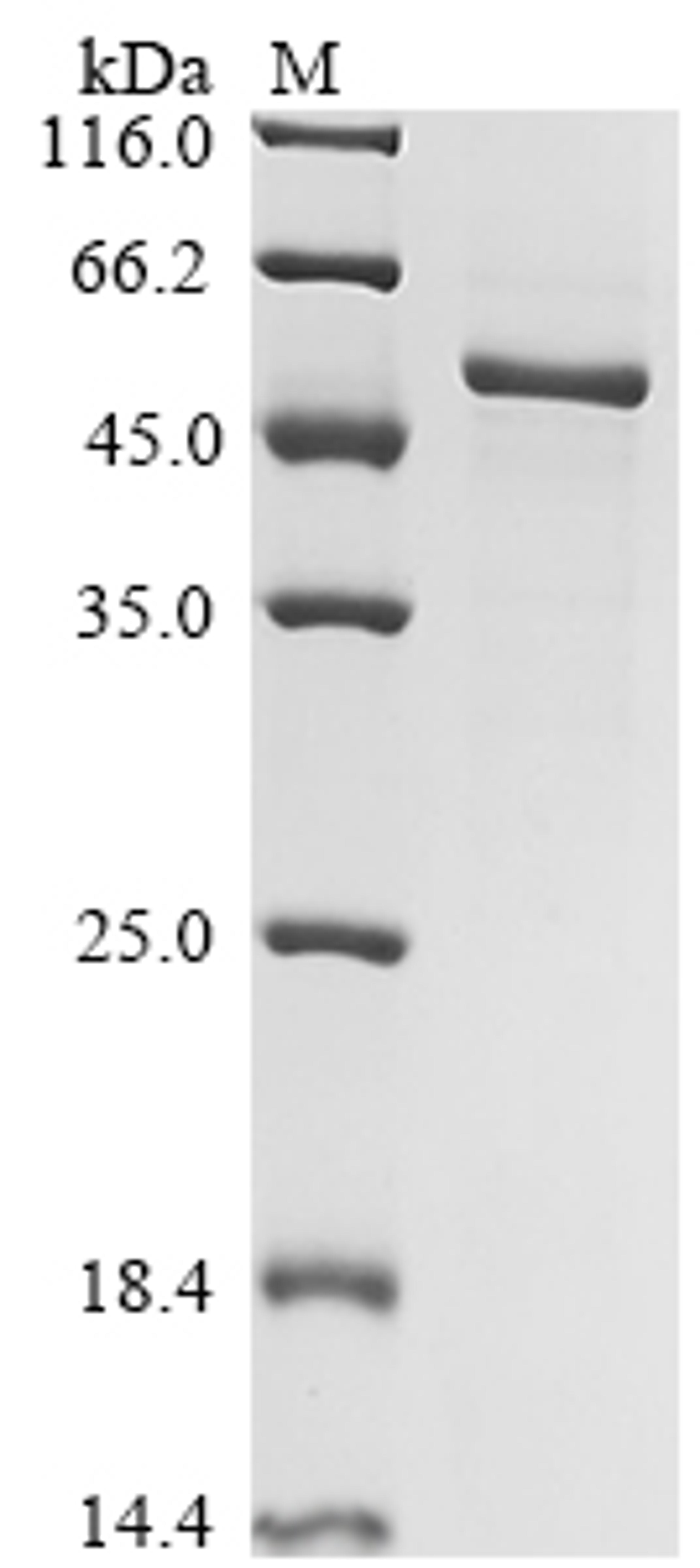 (Tris-Glycine gel) Discontinuous SDS-PAGE (reduced) with 5% enrichment gel and 15% separation gel.