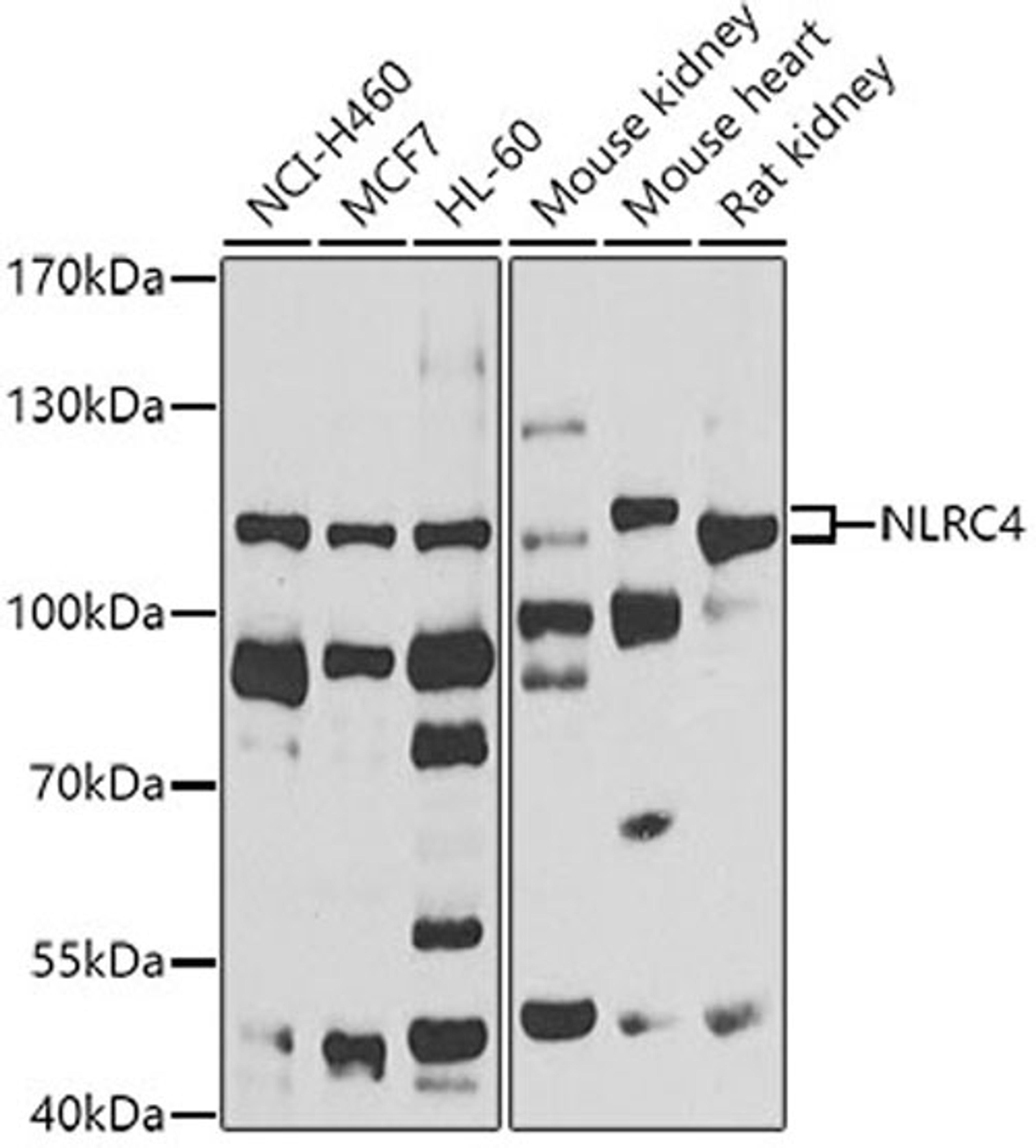 Western blot - NLRC4 antibody (A7382)